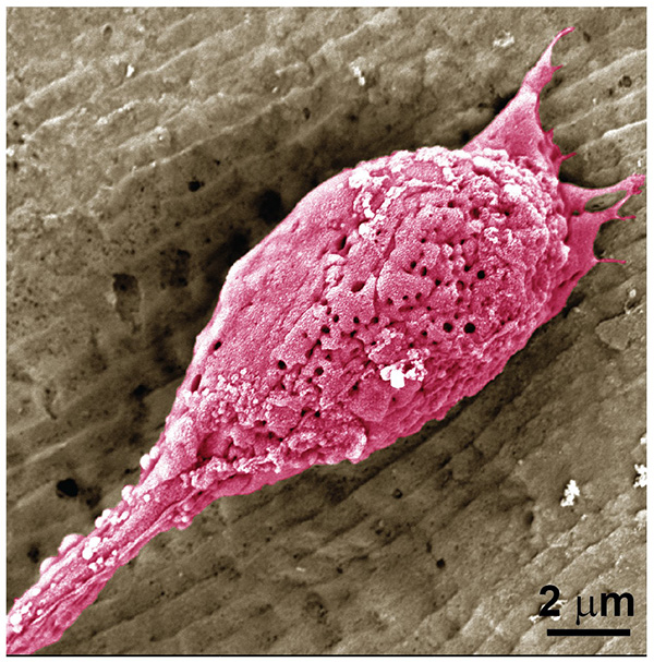 A non-allergenic wheat protein for growing better cultivated meat image